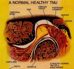 TMD