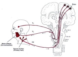 TMJ disorder symptoms