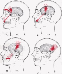 tmj disorder treatment