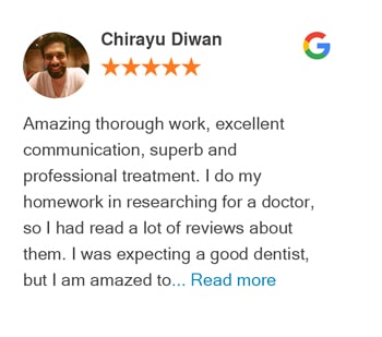 Chirayu Diwan google review for Bellevue Azalea Dentistry