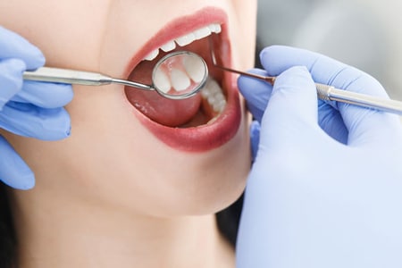 dental cleaning and exams at Bellevue Azalea Dentistry