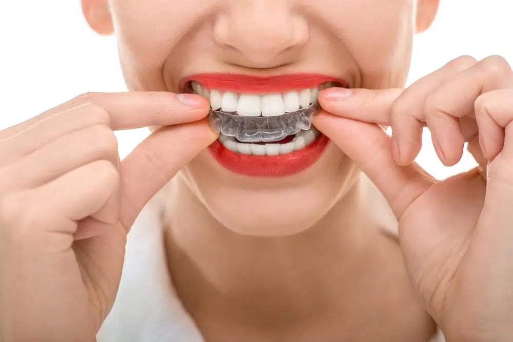 Bellevue Dentist