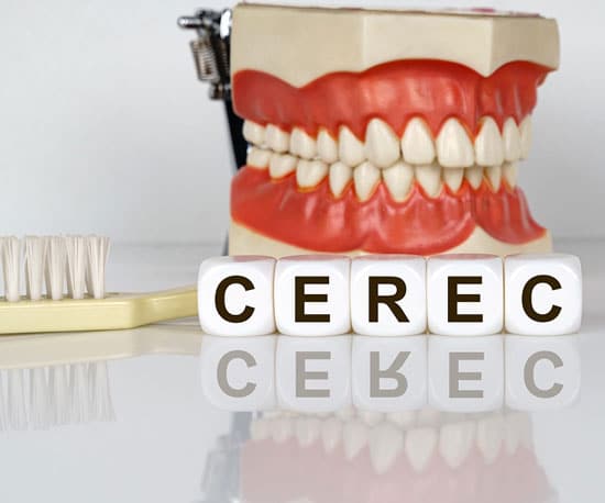 Cerec treatment helps with the restoration of a broken, weakened, or decayed tooth