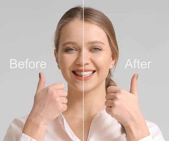 Your smile matters, get smile makeover and we want you to have the most beautiful smile possible, Call Us