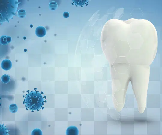 Teeth Whitening bellevue