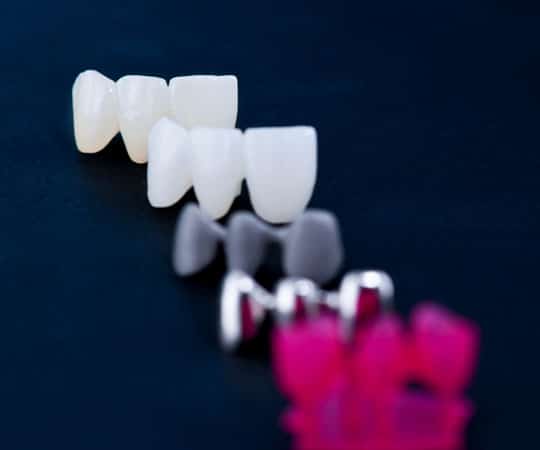 Bellevue Azalea Dentistry offers metal crowns which are a smart option.