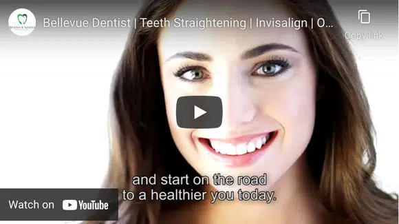 Invisalign bellevue