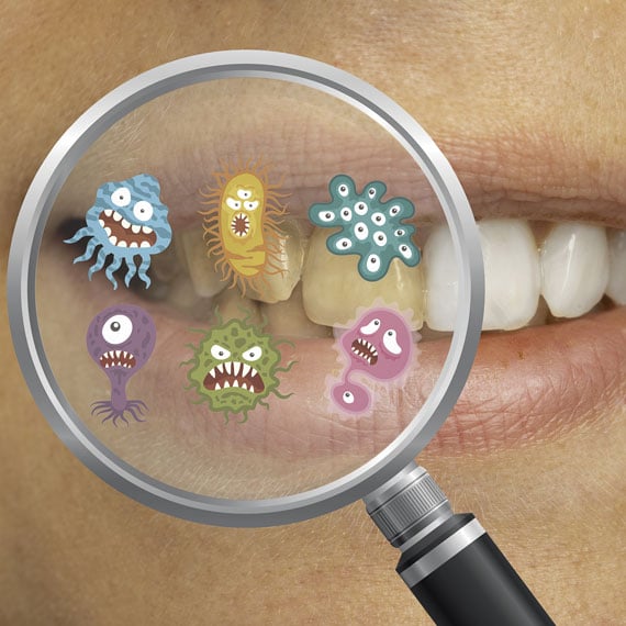 gum-disease-prevention-with-a-few-simple-tips