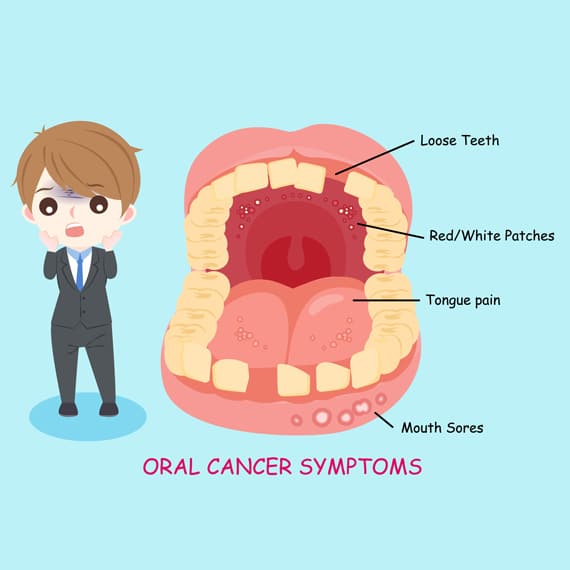 Bellevue Azalea Dentistry offers Oral screening as early diagnosis and prevention are so important.Book an appointment now.