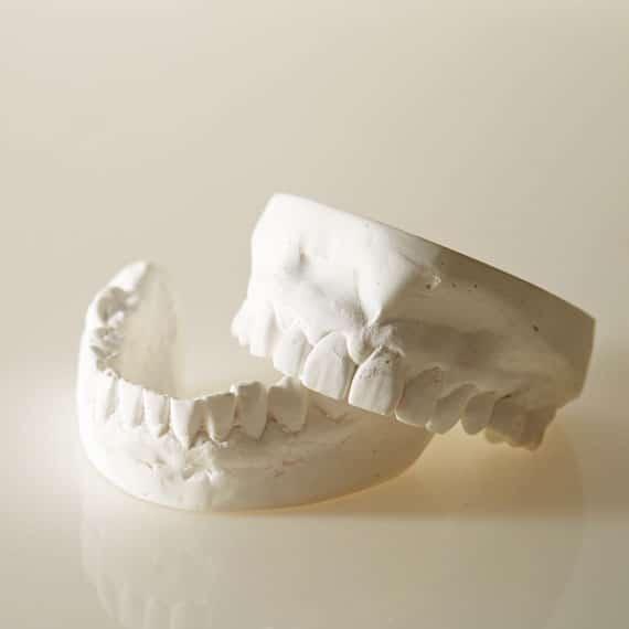 Never attempt to fix your broken denture, visit Bellevue Azalea Dentistry today.