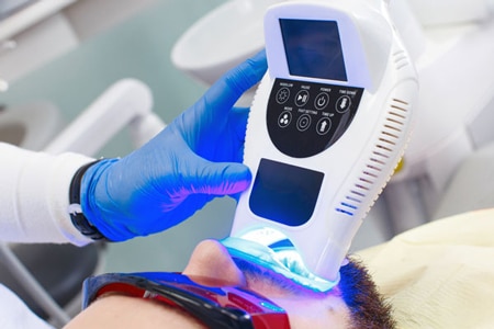 Bellevue Dentist Teeth Whitening