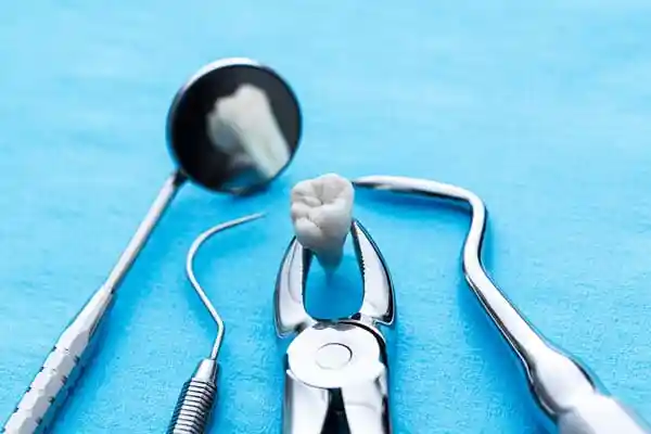 Tооth Extractions Bellevue